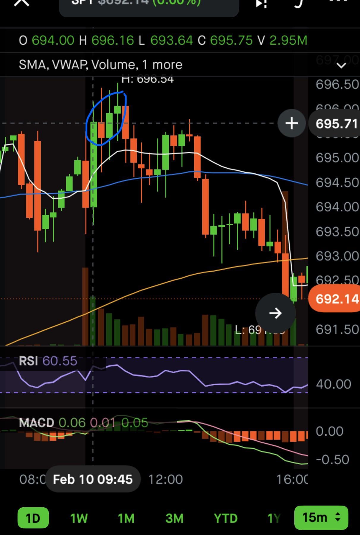 📉 ORB 전략, 이 구간에서 왜 낚였을까요?