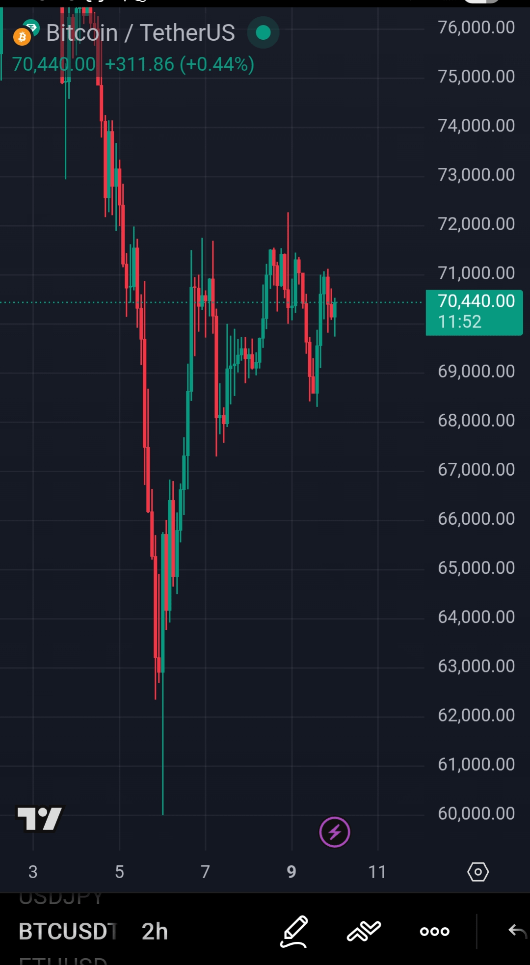 30분 비트코인 차트, 헤드앤숄더 패턴으로 봐야 할까요? 🤔