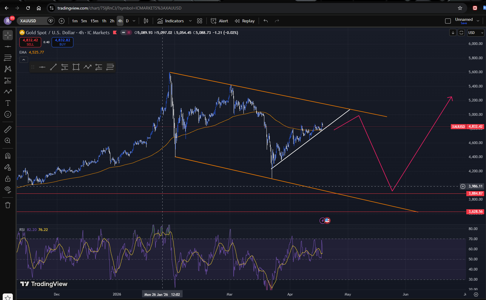 금 시세 전망과 내 단기 매매 계획 💰