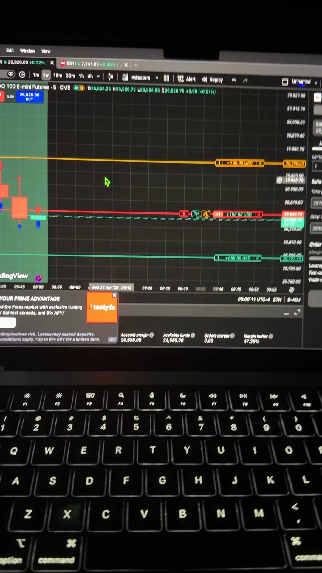 스톱로스가 원가 이상으로 설정되면 거래가 취소돼요. 이게 정상인가요? 🤔