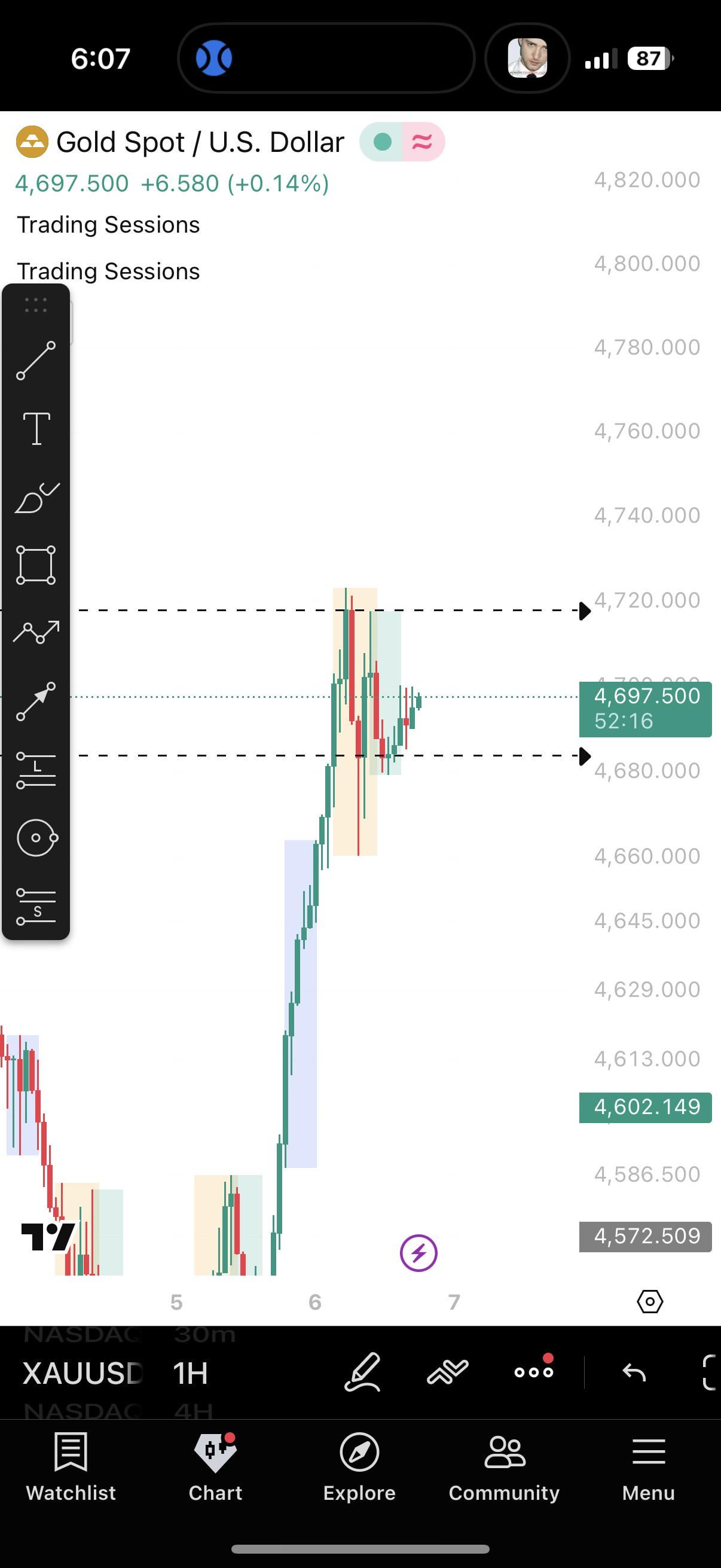 차트 추세 판별 방법에 대한 질문📈